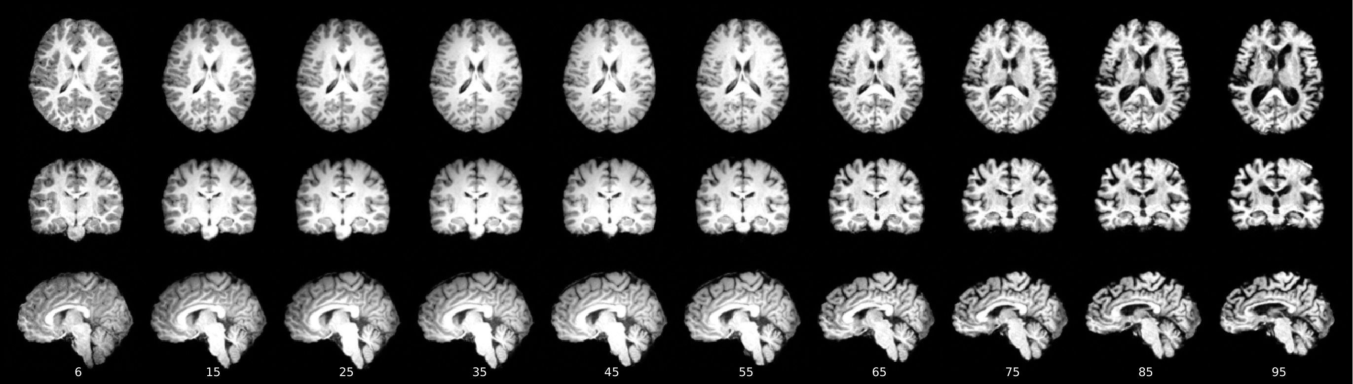 Axial, coronal and sagittal views of a single synthetic brain generated by FlowLet as the age condition is swept from 6 to 95 years with a fixed noise seed.