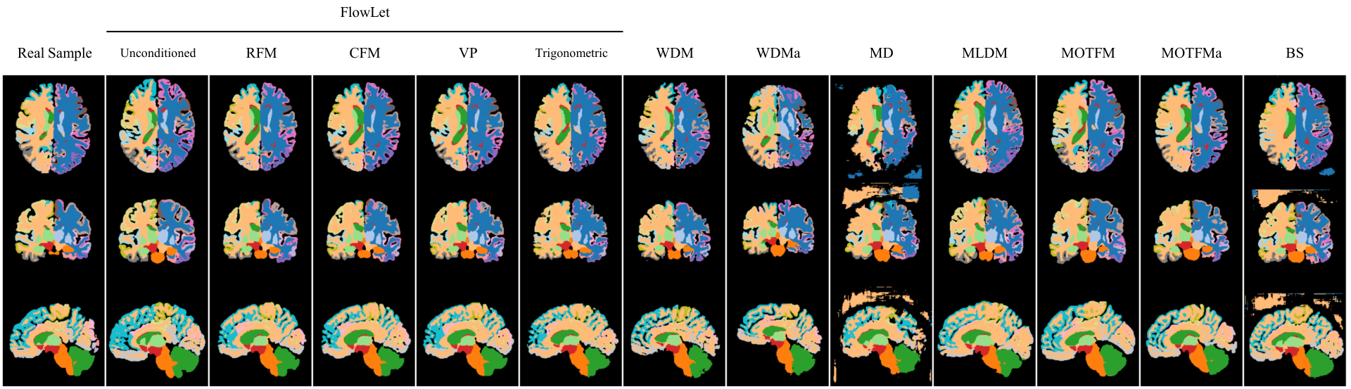 FastSurfer ROI parcellations (colored region maps) for a real sample, FlowLet variants and other methods across three planes.