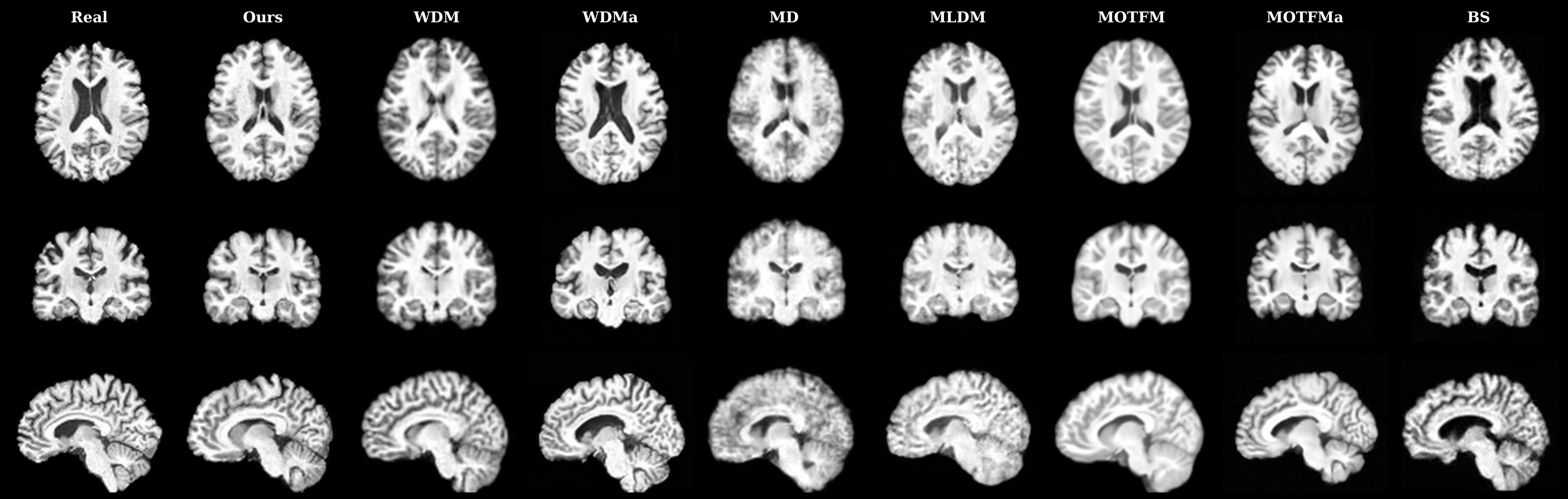 Axial, coronal and sagittal slices comparing a real scan, FlowLet (Ours), and seven other 3D brain MRI synthesis methods.