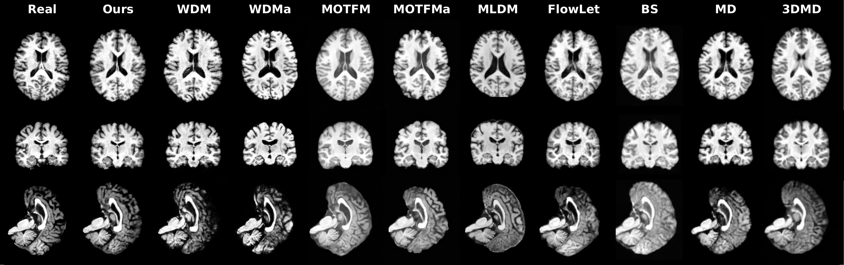 Axial, coronal and sagittal slices comparing a real 72-year-old subject, WaveDiT (Ours), and nine other 3D brain MRI synthesis methods at the same target age.